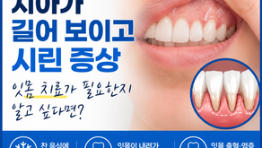 잇몸이 내려가면서 치아가 길어 보이고 찬 음식 먹을 때 시린 증상이 심해져 잇몸 치료가 필요한지 알고 싶을 때
