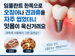 임플란트로 단단하고 질긴 음식을 씹은 뒤 잇몸이 욱신거린다면 확인할 점, 김해 외동 미소치과에서 알려드립니다.