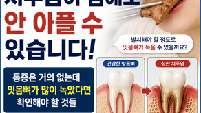 치주염이 심한데 안 아파도 발치할 만큼 잇몸뼈가 녹을 수 있나요? 김해 외동 미소치과에서 알려드립니다.