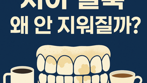 양치만으로 안 없어지는 치아 얼룩, 왜 생기죠? – 치아 착색 종류별 해결법
