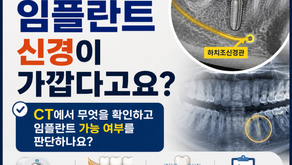 아래 어금니 임플란트, 신경이 가깝다고 들었다면 CT에서 무엇을 볼까요? 김해 외동 미소치과에서 알려드립니다.