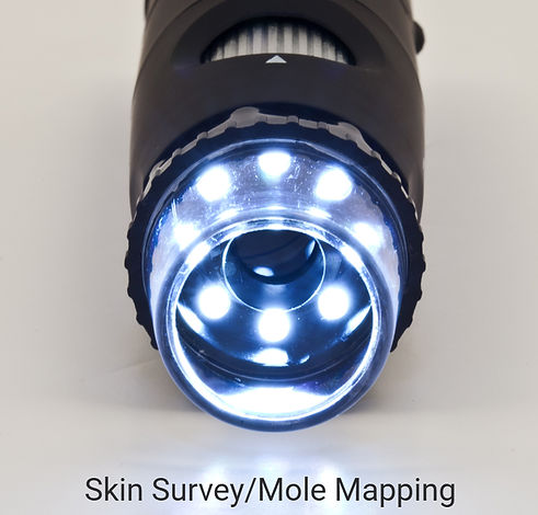 Dermoscope_edited.jpg