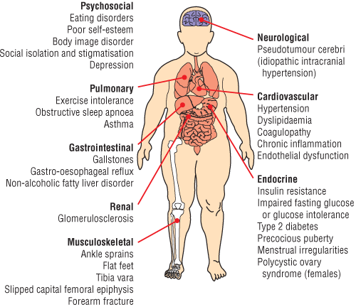obesity risks the Center for Bariatric Surgery westchester dutchess rockland new york
