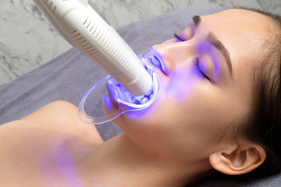 MODE Aesthetics LED Teeth Whitening
