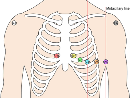Decoding the Heart's Rhythm: The Science and Practicality of ECG Machines