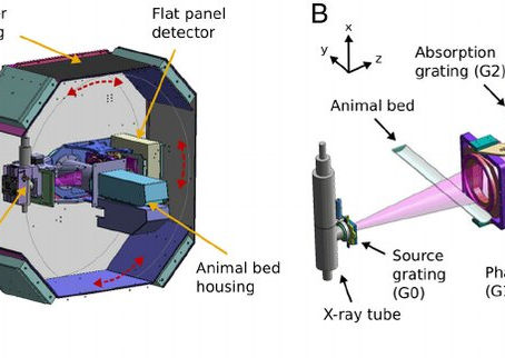 Unraveling the Wonders of CT Scanners