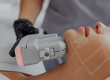 Tecnologias de Rejuvenescimento (2).png