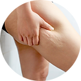 thigh.png