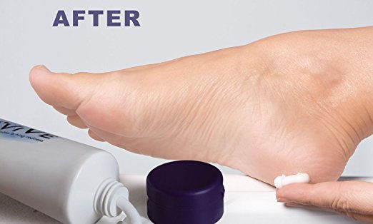 Thumbnail: Nvive Cream - Heals Cracked Skin - Calms Itching Redness