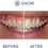 Thumbnail: Strength Teeth Whitening Serum