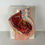Thumbnail: Female Reproductive System Anatomical Model