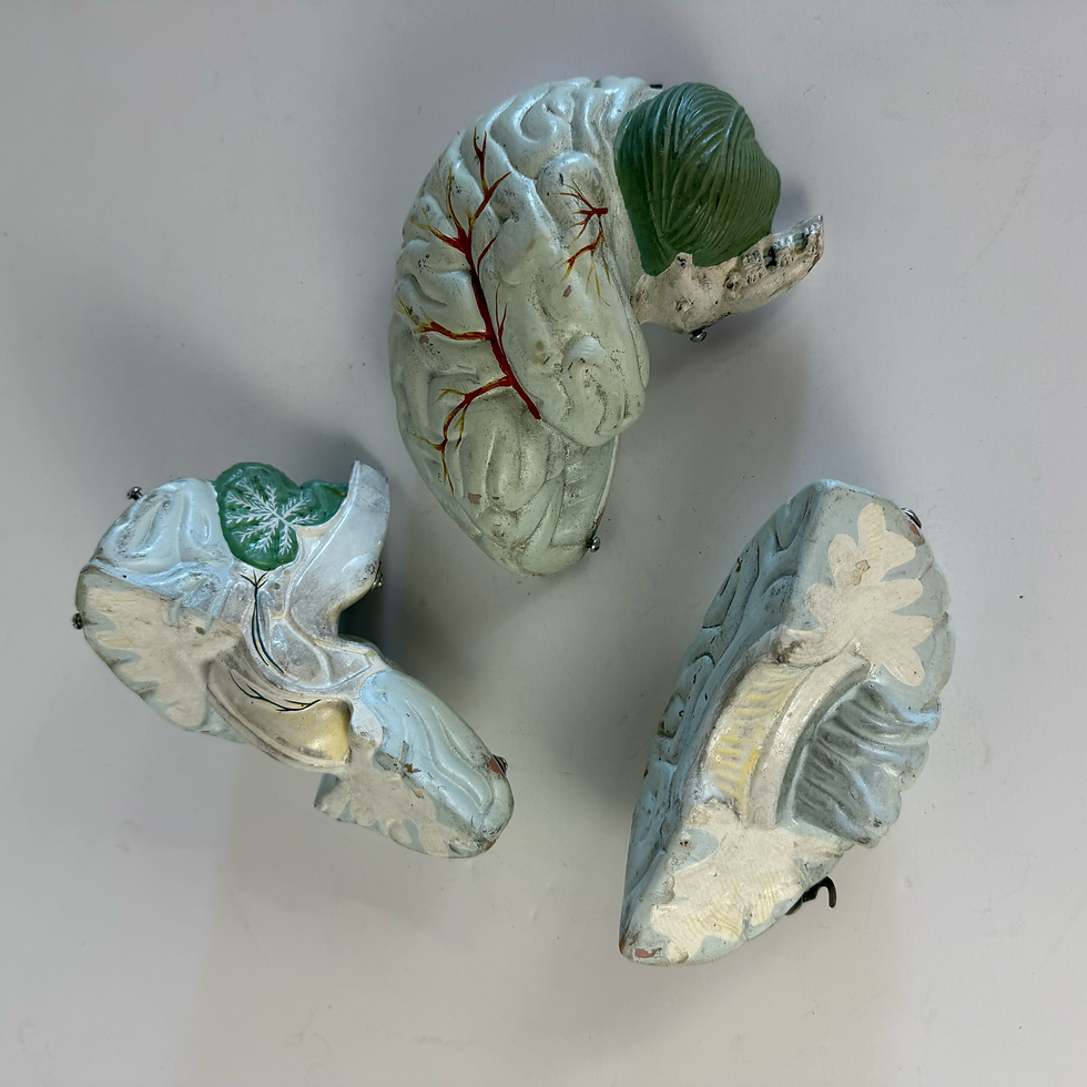 Thumbnail: Multi Part Brain Anatomical Model