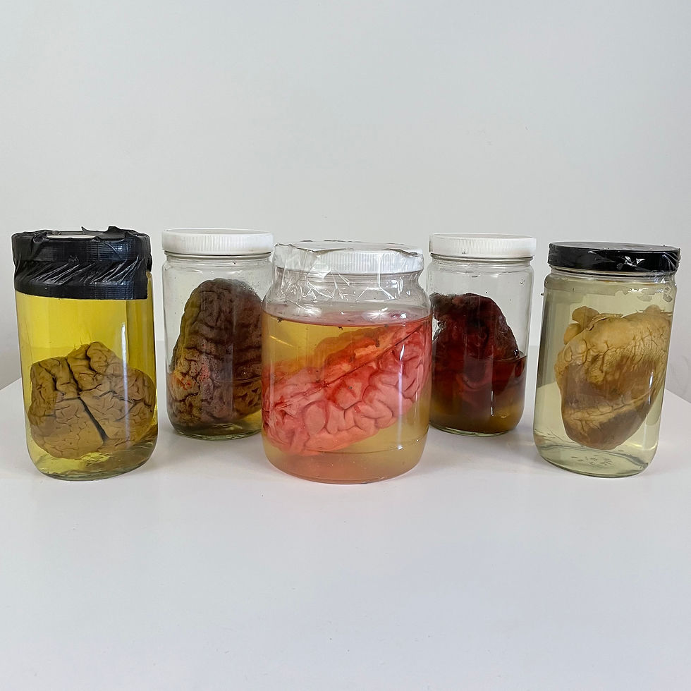 Specimen Jars