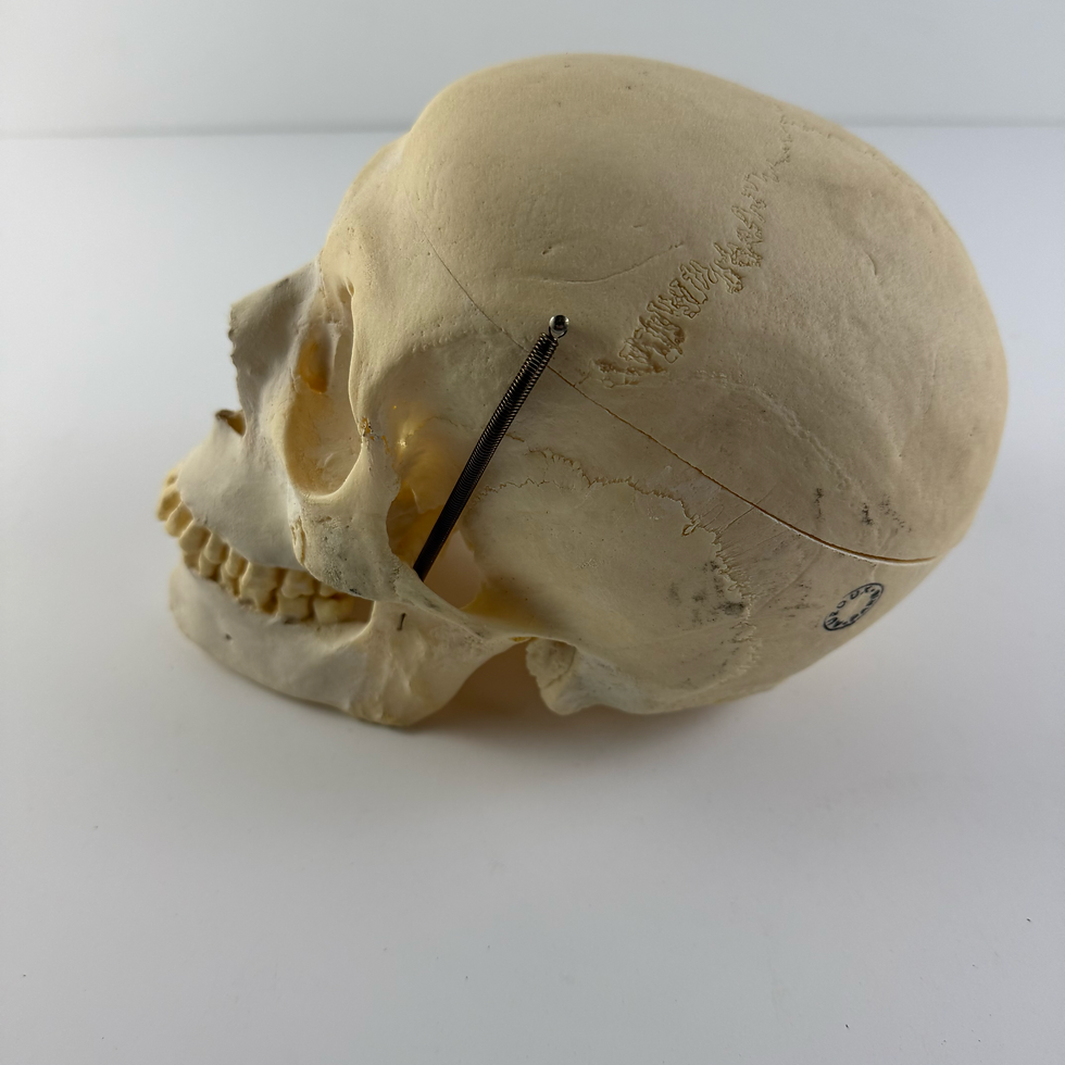 Thumbnail: Human Skull in Black Box