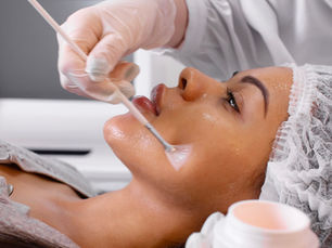 Peeling PRX-T33 : peeling sans peler pour toutes peaux à Nice