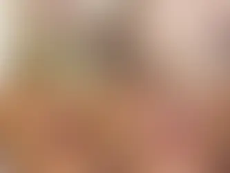 Peeling PRX-T33 à Nice