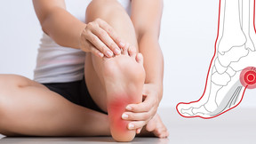 Plantar Fasciitis - SIPRO & ESP Medical Updates