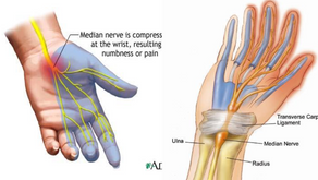 CARPAL TUNNEL