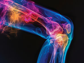 Instabilità articolare