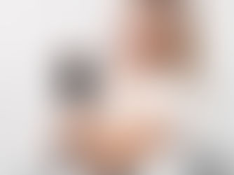 Tendinopatie croniche e Proloterapia | Esperienze cliniche