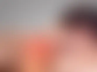 Dolore cervicale | Quando non è più solo un fastidio e serve una valutazione specialistica