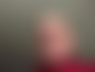 La Proloterapia e la Società Italiana -SIPRO- che si occupa di questa metodica