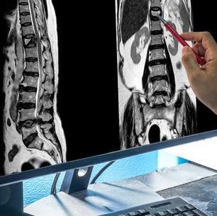 Perché due risonanze identiche raccontano due storie diverse: la verità che cambia la cura della colonna