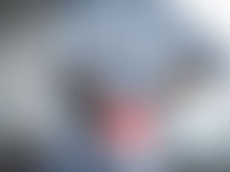 Chirurgia Vertebrale: aspettative realistiche, risultati e cosa sapere prima di operarsi