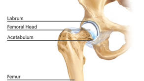 HIP PATHOLOGY