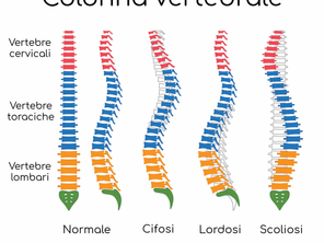 "Dimentica il Mal di Schiena" 