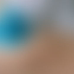 Proloterapia e Ginocchio