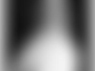 Episode 79 – Samantha | My Body. My Story PODCAST| 45 Over 45 chapter