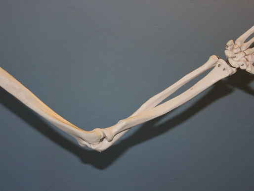 Disability for Cubital Tunnel Syndrome (CBTS)