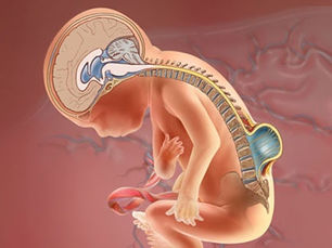 Xiao Procedure Successfully Treats Bladder and Bowel Incontinence in Girl with Myelomeningocele from Huaihua, Hunan