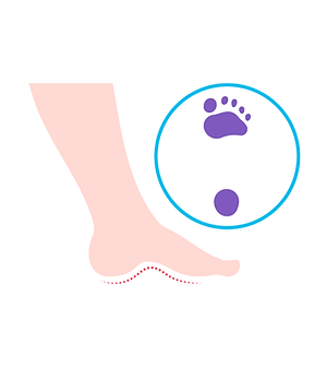 Pes Kavus (Çukur Taban).png