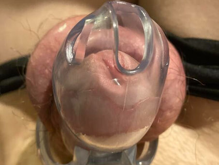 Témoignages en images; chasteté masculine 32