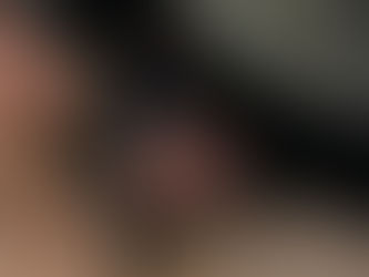 Photo-témoignages Cage de chasteté 39