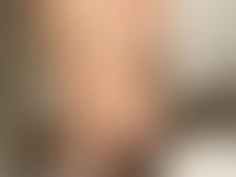 Photo-témoignages Cage de chasteté 35