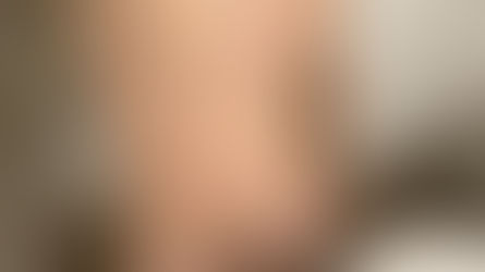 Photo-témoignages Cage de chasteté 35