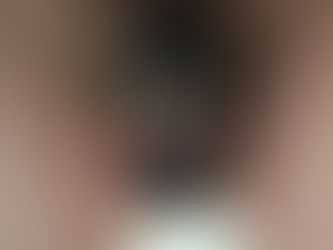 Photo-témoignages Cage de chasteté 13