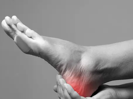 Plantar Fasciitis & Acupuncture FAQ: Everything You Need to Know
