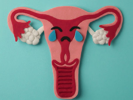 Endometriosis and Fertility