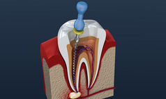 Endodontia