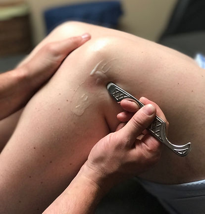 Instrument Assisted Soft Tissue Technique (commonly known as Graston Technique) 