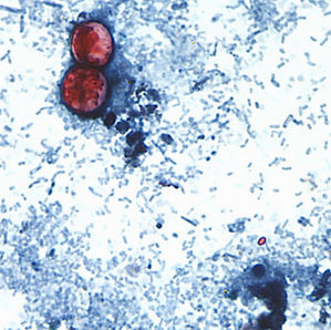 Micrografía de una muestra teñida en azul con dos quistes rojos ovalados y muchas bacterias dispersas sobre fondo blanco.
