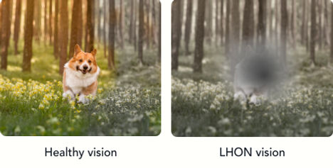 Corgie_Healthy_LHON_vision_edited.jpg