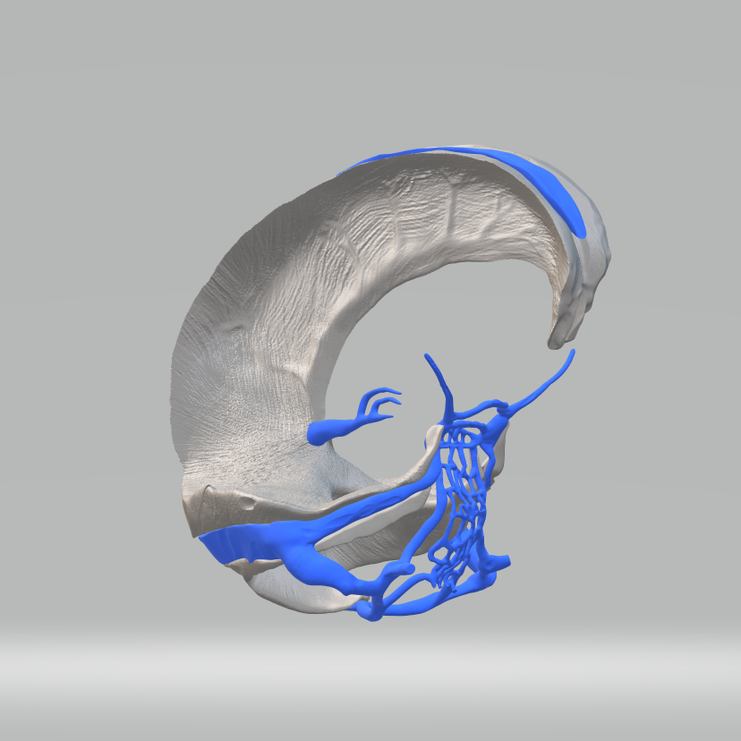 Miniaturbild: Falx Cerebri, Falx Cerebelli, Tentorium Cerebelli & Dural Venöz Sinüs Seti