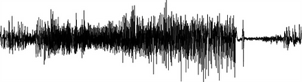 seizure.png