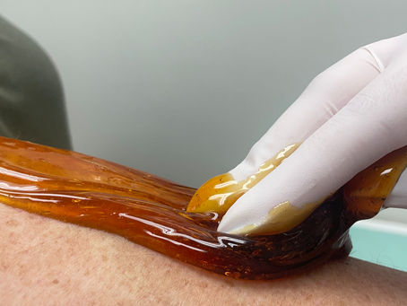 Why Sugaring is the Better Choice for Hair Removal (and Why Not Everyone Offers It)