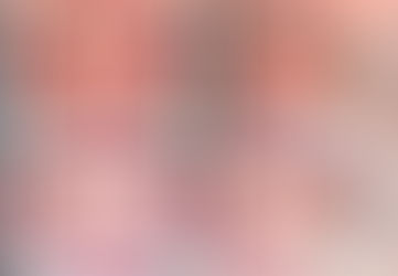 如何利用早期矯正，成功解決II類咬合不正